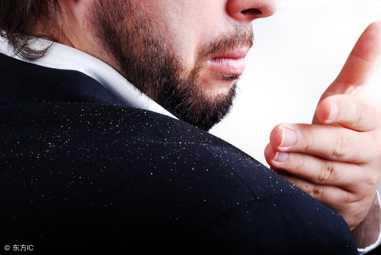 头屑过多是什么原因,头屑是什么原因造成的如何解决