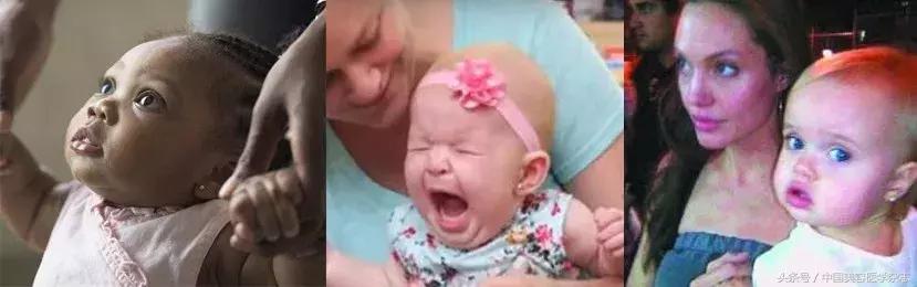 为什么打耳洞臭臭的,刚打的耳洞流黄水臭臭的怎么办