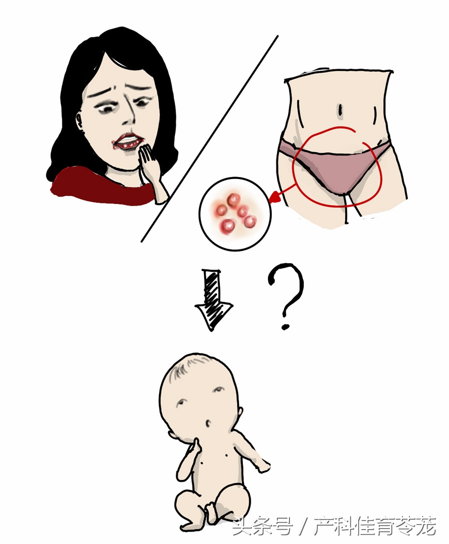 小孩感染单纯疱疹危险吗,1型与2型单纯疱疹病毒感染区别