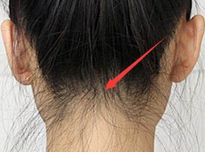 碎发多怎样才能让碎发变好看,超短碎发怎么补救女生