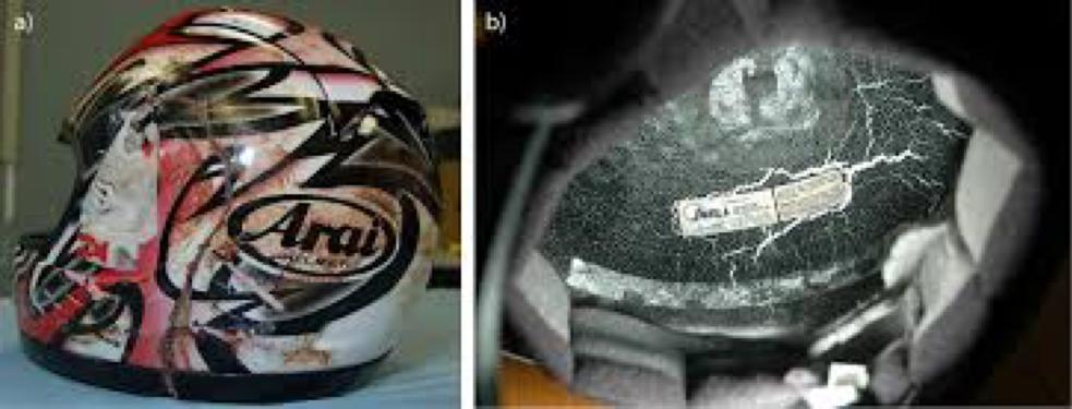 澶寸洈璐拱鎸囧崡,澶寸洈璐拱璁板綍