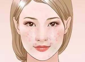 让毛孔变小最快的方法学生,让毛孔变小用什么药