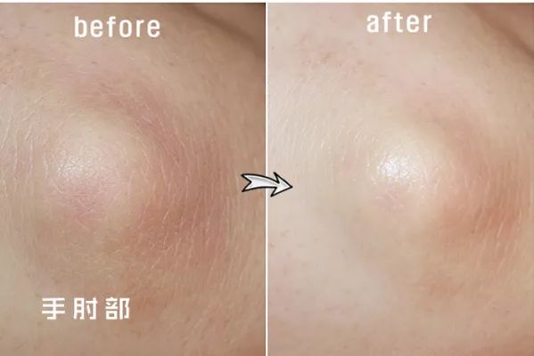擦掉一张皮，双脚换皮术！死皮、老茧一喷就没，15秒还原嫩白玉足