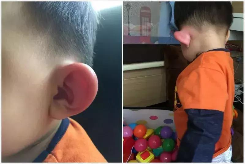 止痒神器,青草膏止痒效果怎么样