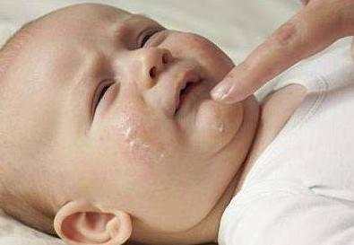 婴儿得了湿疹宝妈不能吃哪些食物,宝宝湿疹宝妈能吃什么不能吃什么