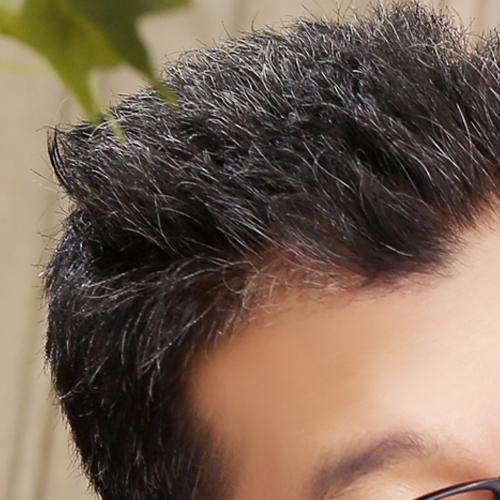 少年白是缺什么营养,什么原因导致少年白