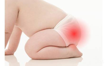 如果孩子经常有这3种表现,那可能“长蛔虫”了,宝妈可别大意了