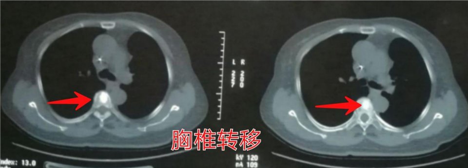 治疗癌症的靶向药能不能停,靶向治疗药物任何癌症都可以吃吗
