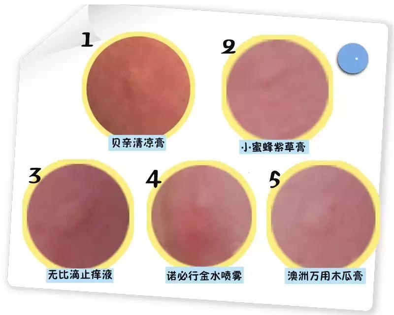 宝宝被蚊子叮了怎么止痒消肿？测评后我发现网红产品竟然最有用！