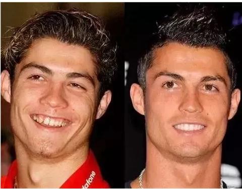 c罗整容过么,c罗整容了没