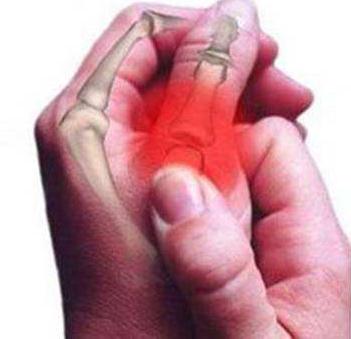 腱鞘炎晨僵怎么治疗,一招解决腱鞘炎晨僵