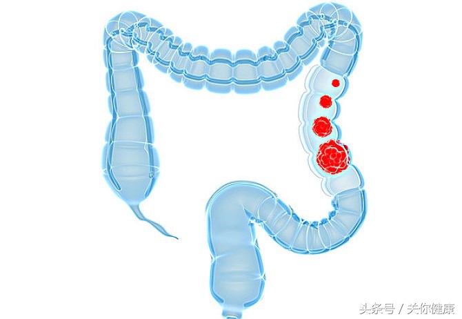 腹痛便血是缺血性结肠炎吗,结肠炎是间歇性的便血吗