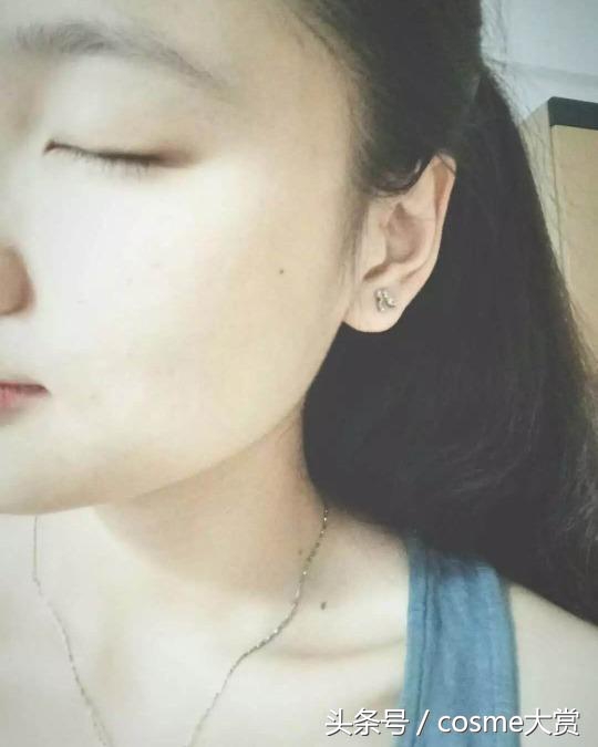 10年祛痘成功指南敏感痘肌,超全祛痘攻略养成不长痘肤质