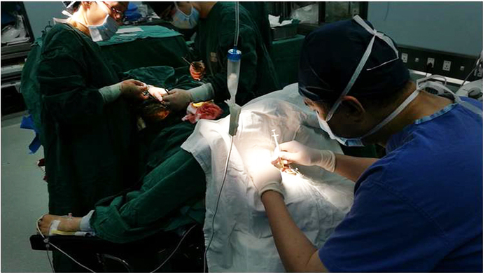 治疗视网膜动脉阻塞专家,一名医生做了两台手术