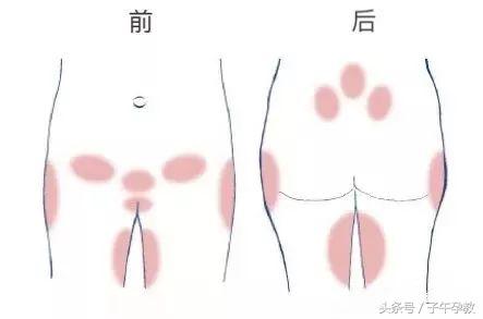 孕期坐久了屁股尾骨疼是怎么回事,孕妇久坐尾巴骨疼怎么回事