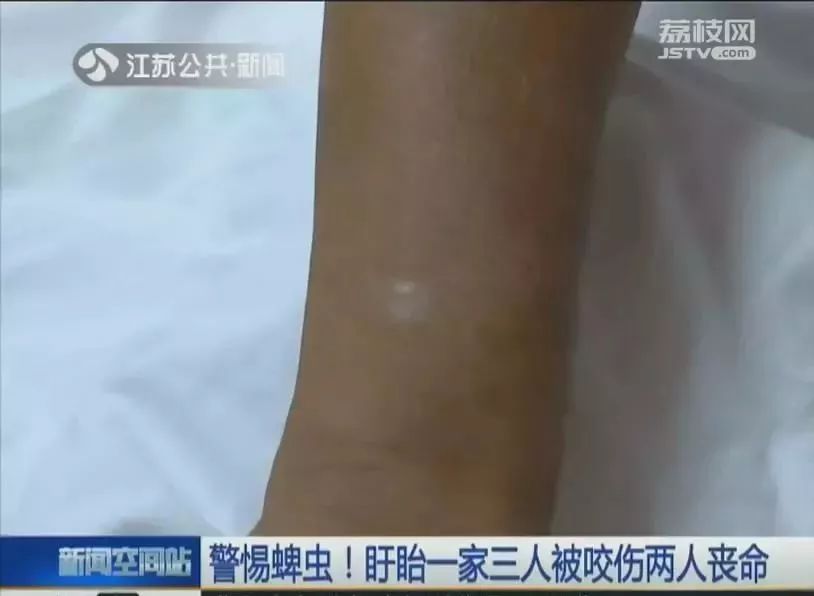 2岁小孩眼睛上突然长了一颗黑痣,2岁小孩眼皮上长了个红疙瘩