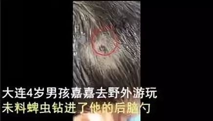 小心“新型艾滋病”，虫子就能传播