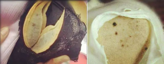 为什么日本女性很少得妇科病,日本女性怎么防护妇科病