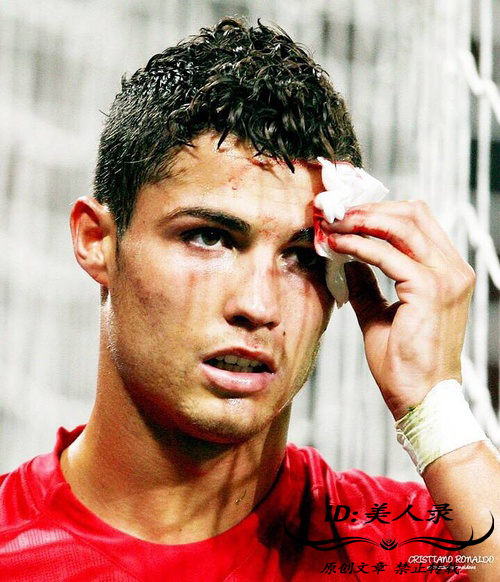 c罗的眼角被撞血流如注,眼角被撞一道口子