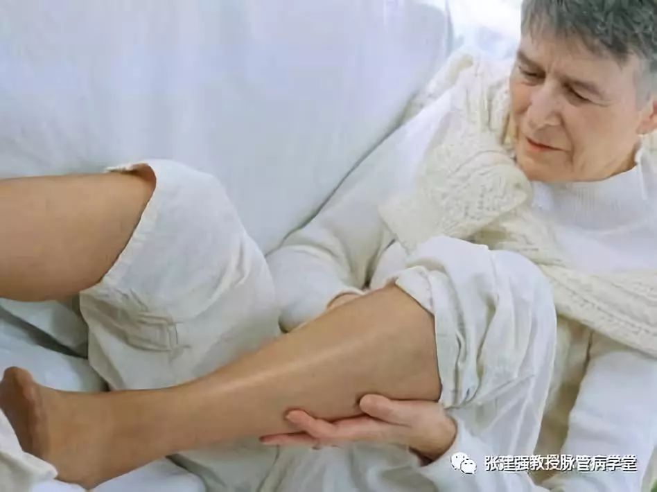 「杏林微科普」暴雨天，外出蹚水淋雨，小心得了脉管炎！