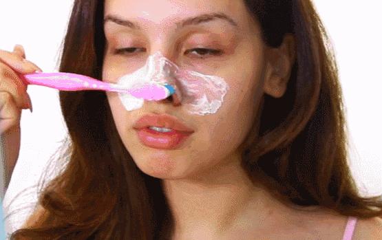 皮肤科科学去黑头的方法,三甲医生教你去黑头