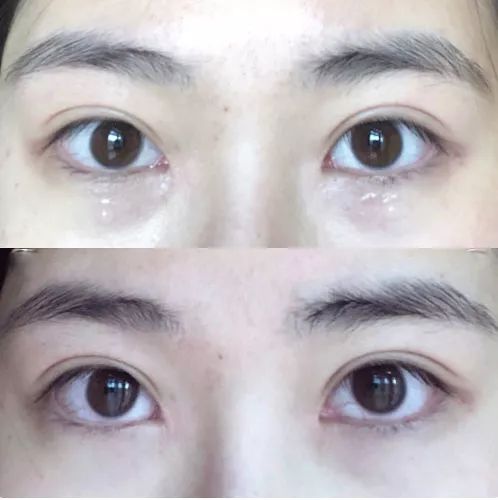 不可错过的超值产品系列,公认最好的三款眼霜