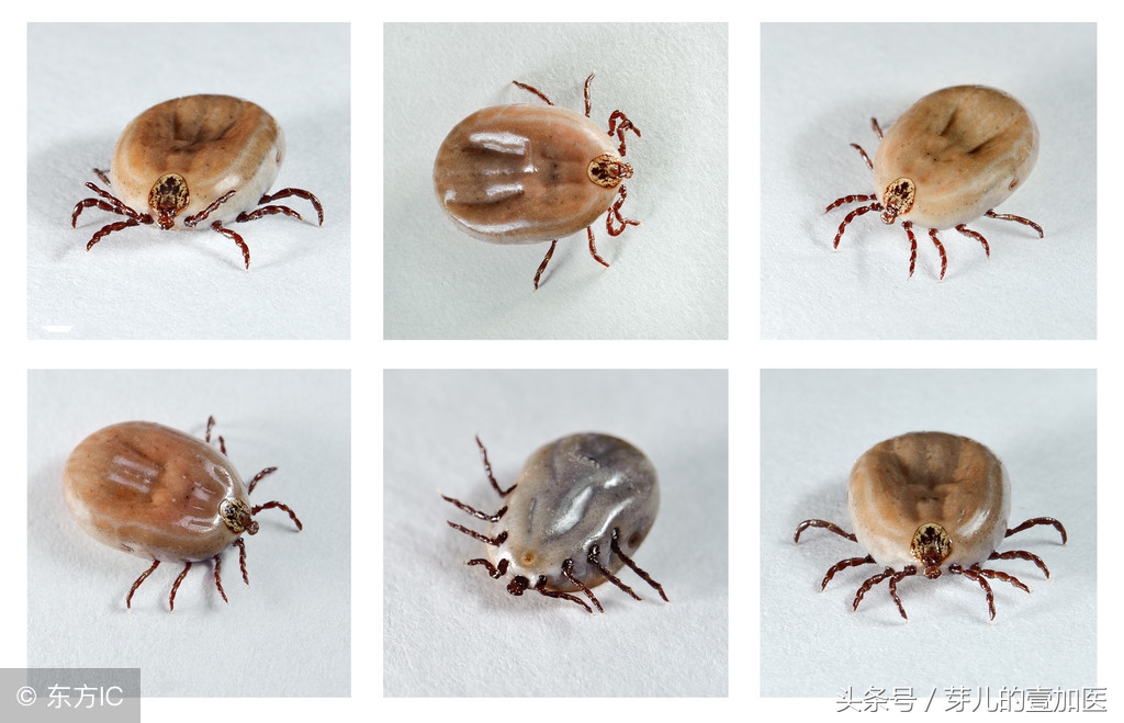 出去郊游如何避免蜱虫,小小蜱虫为什么毒性那么大