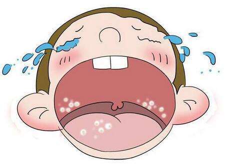 新生儿鹅口疮原因是什么,新生儿鹅口疮引起的原因是什么