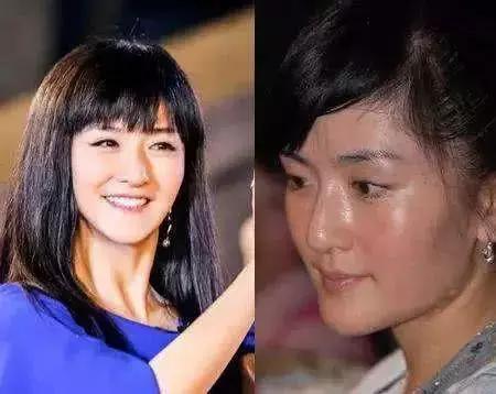 消除油脸小妙招,去除脸部黑油的妙招