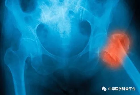 高血压停药的危害,高血压的危害视频