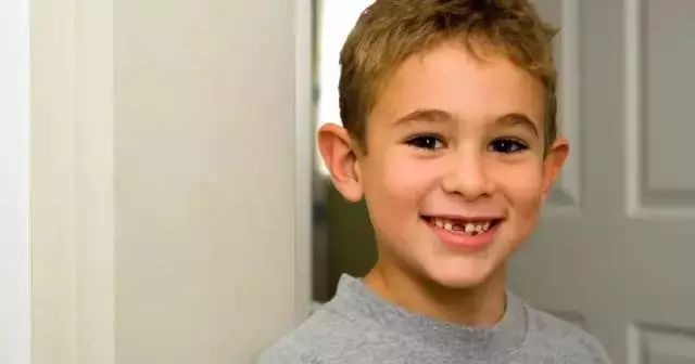 孩子爱问父母问题,孩子换牙期这些事家长必须要知道