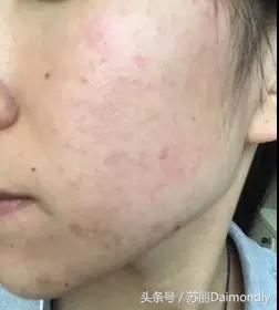 护肤应该是女人每天的必修课,不伤害皮肤的护肤方法