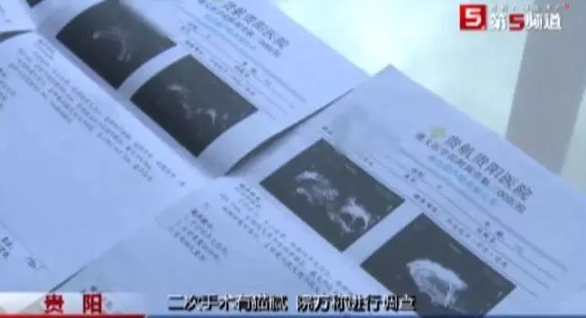 女子手术后肚子大,做流产手术后来月经量非常大