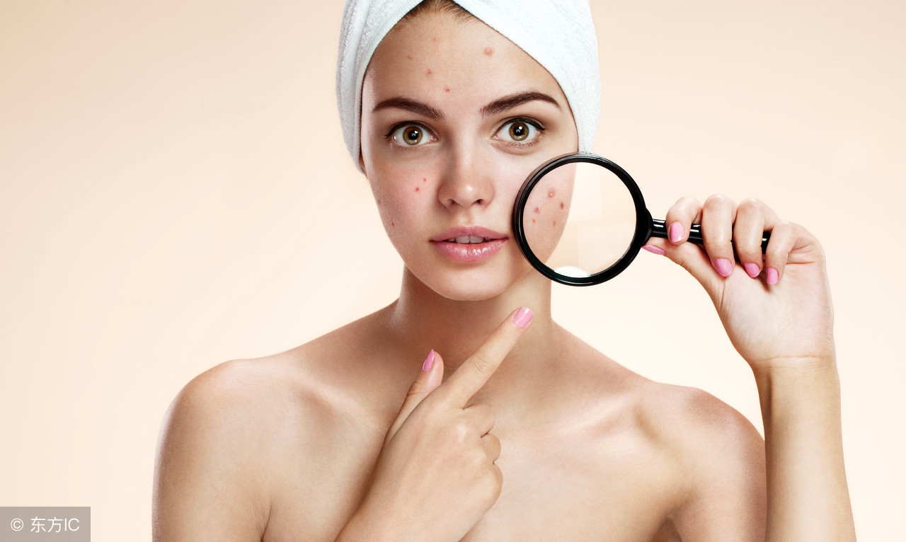 温和有效的去粉刺小窍门,7天改善闭口粉刺细腻光滑肌肤