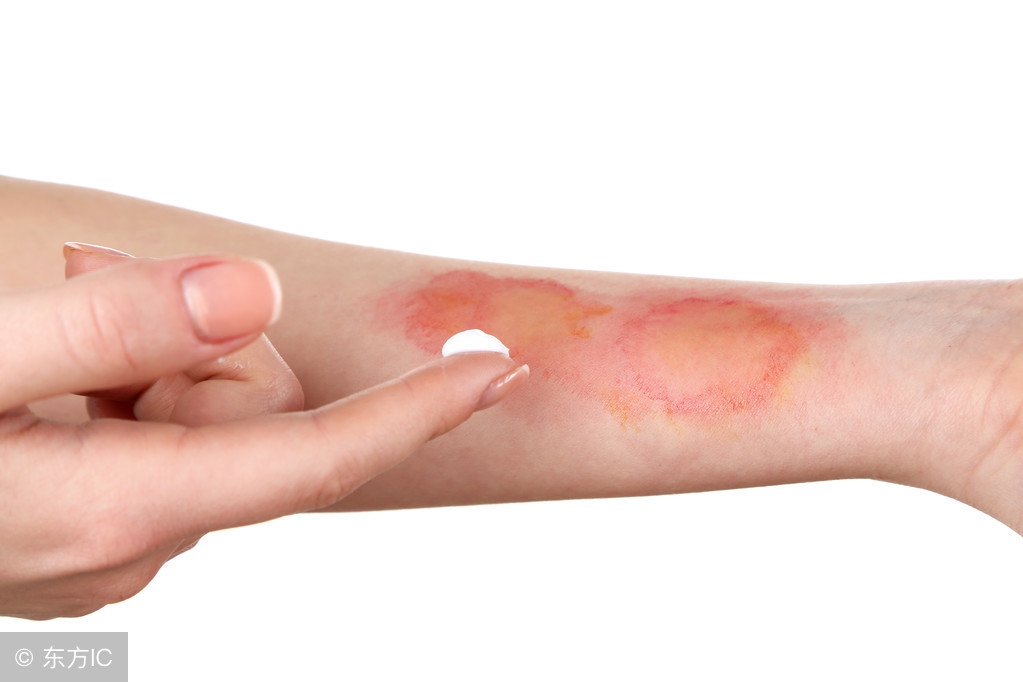 孕妇闻了十几分钟风油精会怎样,孕妇鼻塞不通气可以用风油精吗