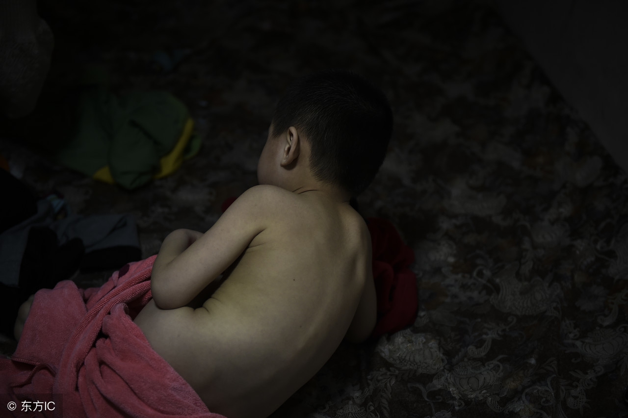 阴囊湿疹夏季高发，3个小方法让你不在害怕它