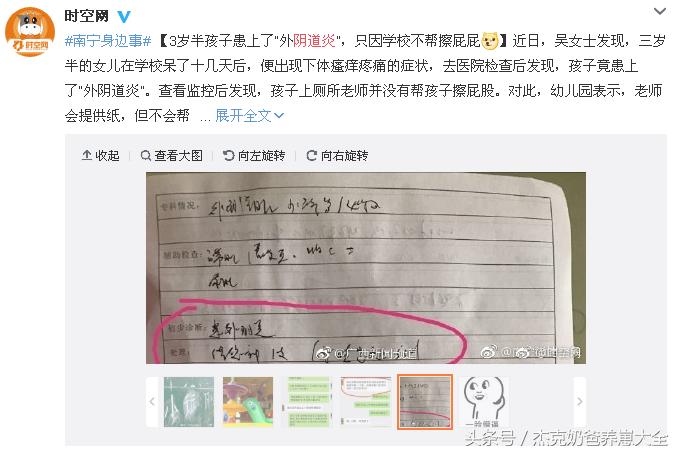 3周岁女宝宝外阴炎用什么药,3岁宝宝反复外阴炎