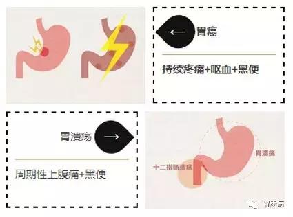 便血详细介绍,便血警惕6种原因