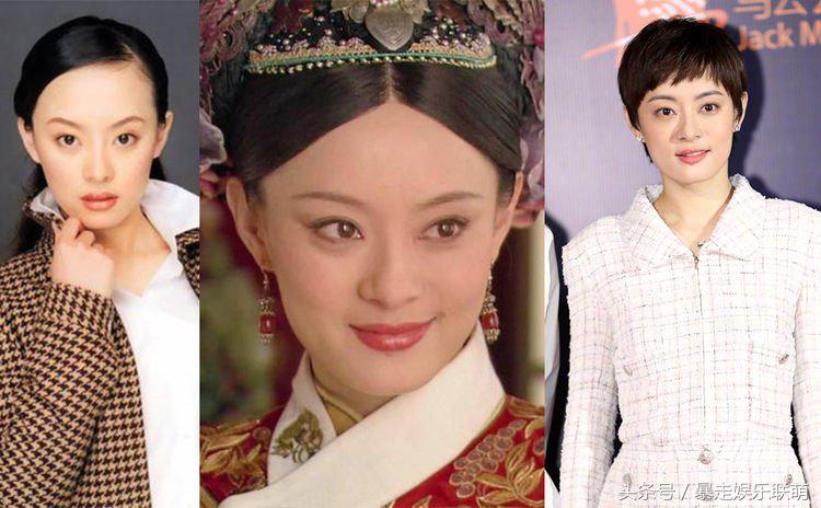 女明星的发际线高的是怎么回事,额头发际线高很难看怎么办