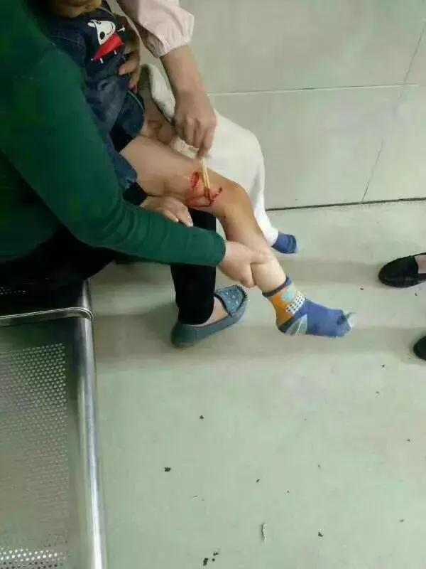 被狗紧咬怎么办,被狗咬住怎样才能挣脱