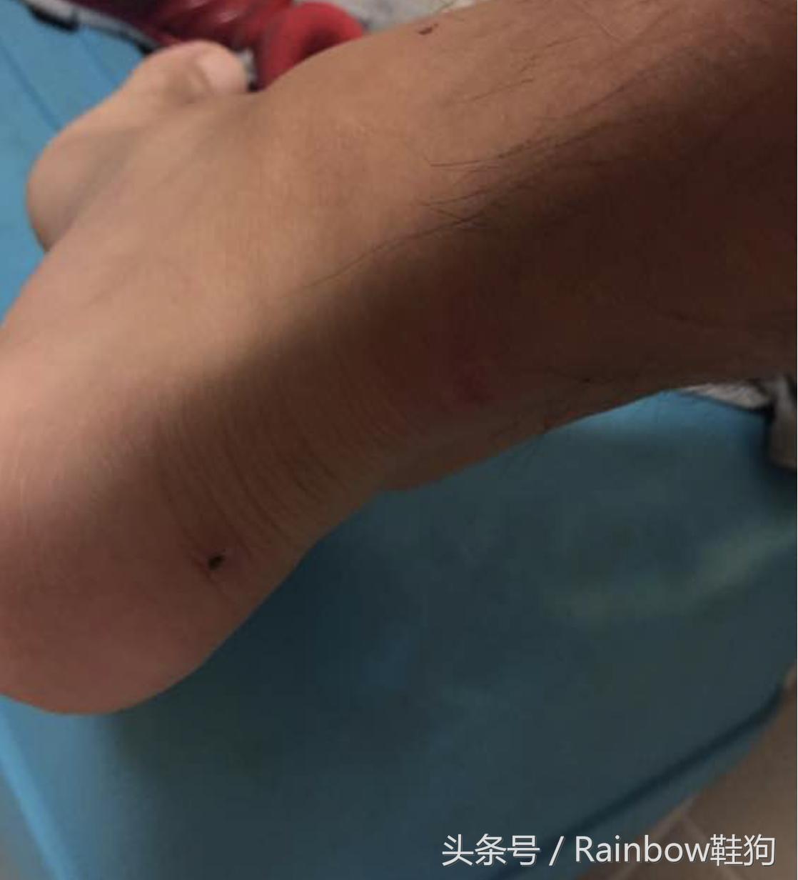 aj1修理皮面多少钱,aj1鞋内跟磨破了怎么修补