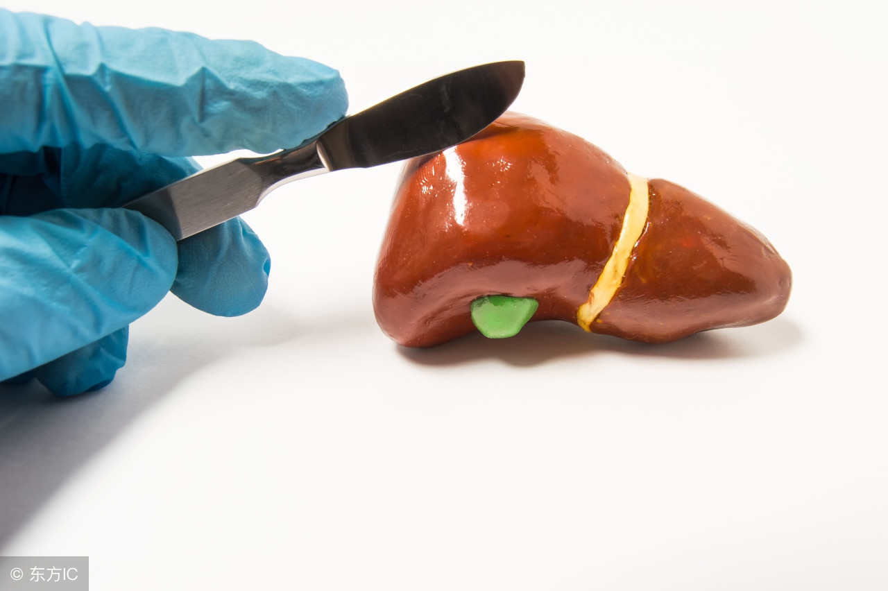 胆结石是什么怎么治疗,有了胆结石如何避免胆结石发作