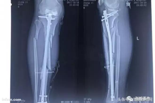 廊坊民营医院院长跳楼后续：人大代表涉黑，31名国家工作人员涉案