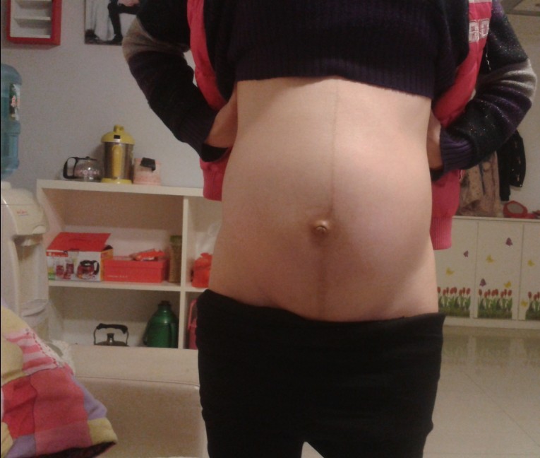 怀孕37周想提前顺产有什么办法吗,有孕37周自然发动生孩子的吗