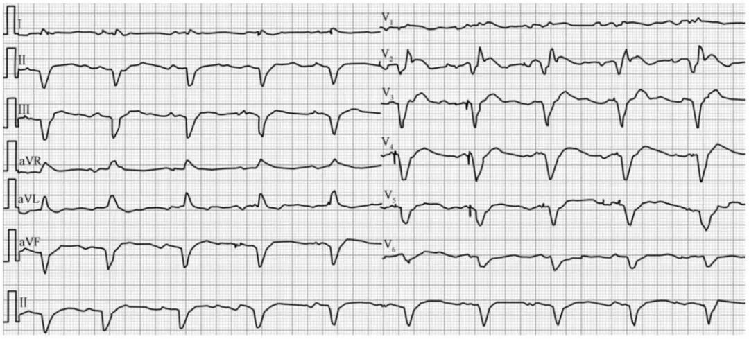 协和医院疑难杂症案例,协和医院疑难杂症视频