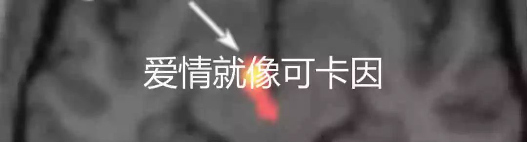 我们仍在痛苦地等待一剂解酒药