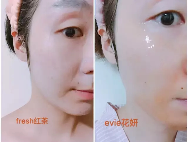 护肤面膜夏天,护肤干货4招教你挑选一款好面膜