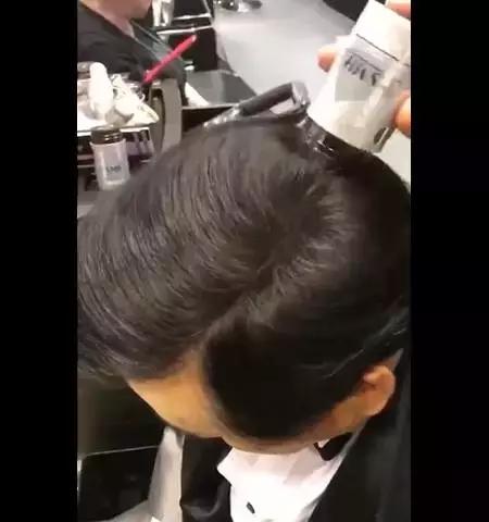 惨！90后集体脱发，发际线一去不复返！