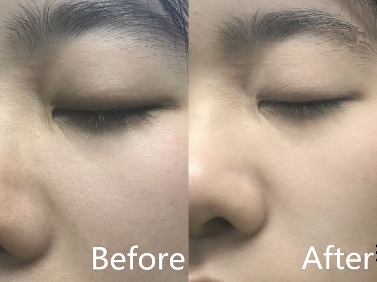 luna洁面仪日版和韩版哪个好,亲测好用四款洁面