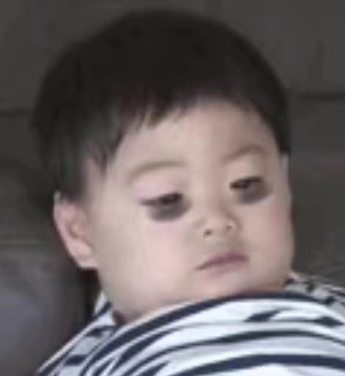 去眼细纹的眼霜,消除眼细纹眼霜